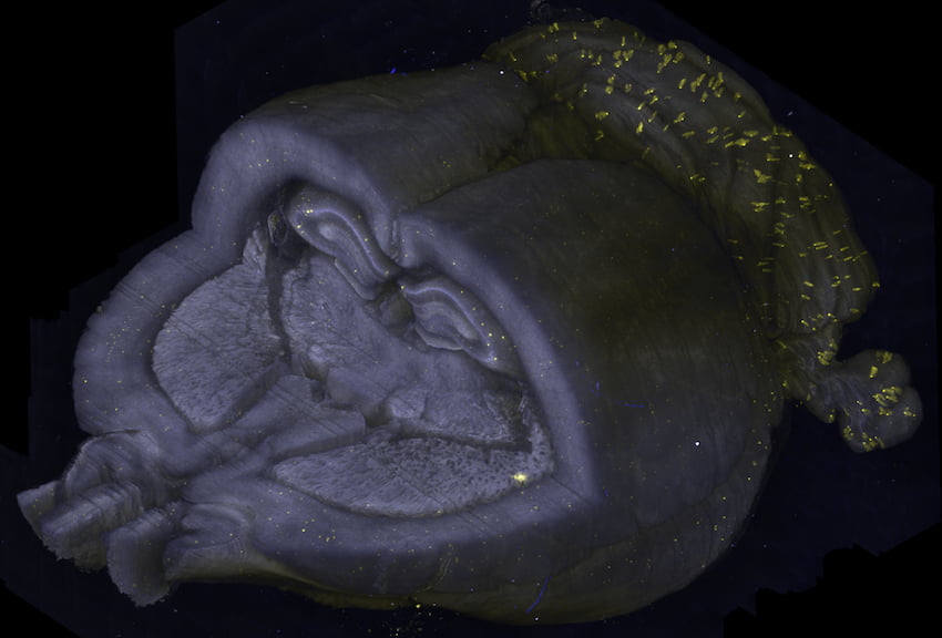 Whole-brain 3-D imaging