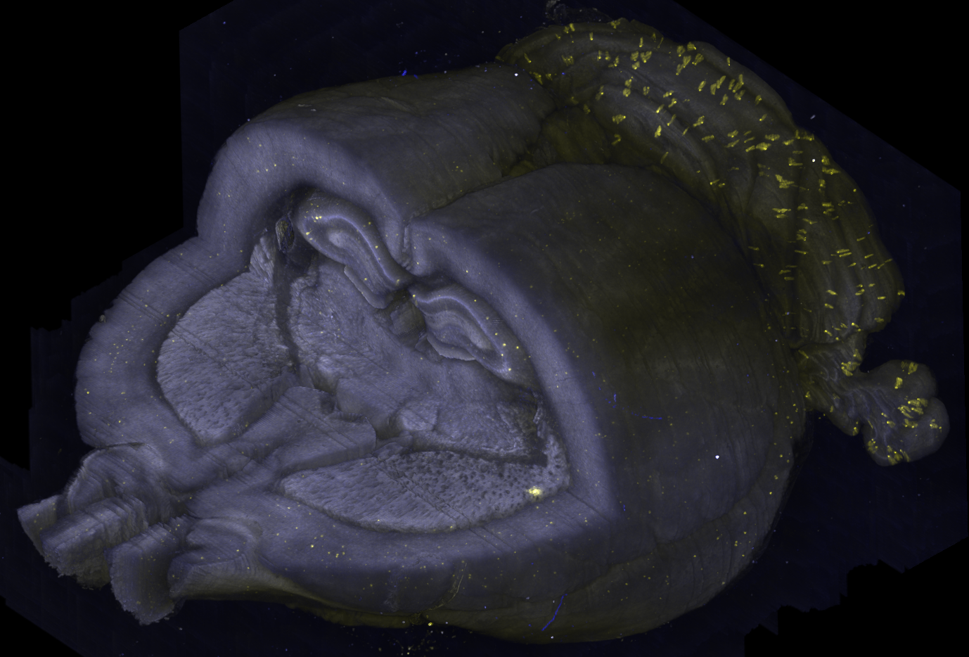 Whole-brain 3-D imaging