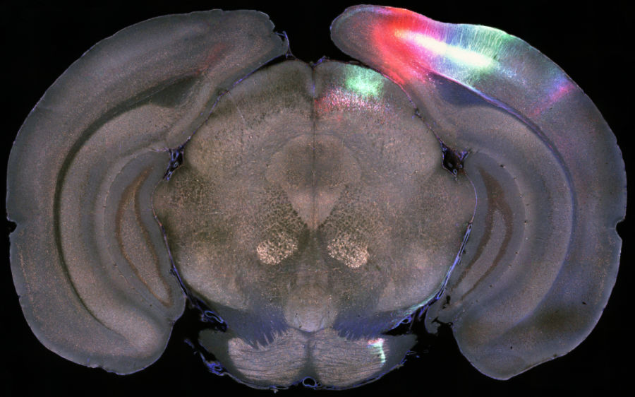 RGB imaging showing high-quality 3-fluorophore acquisition from a BrainSaw serial section 2-photon tomography system